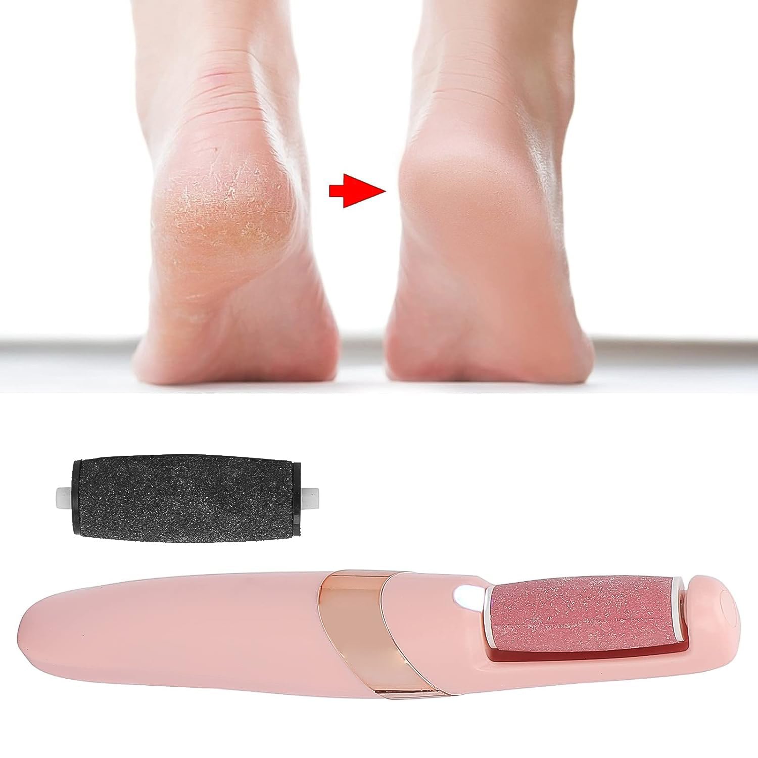 Flewless Pedi Electronic Pedicure Tool (1 Set) Your Brand