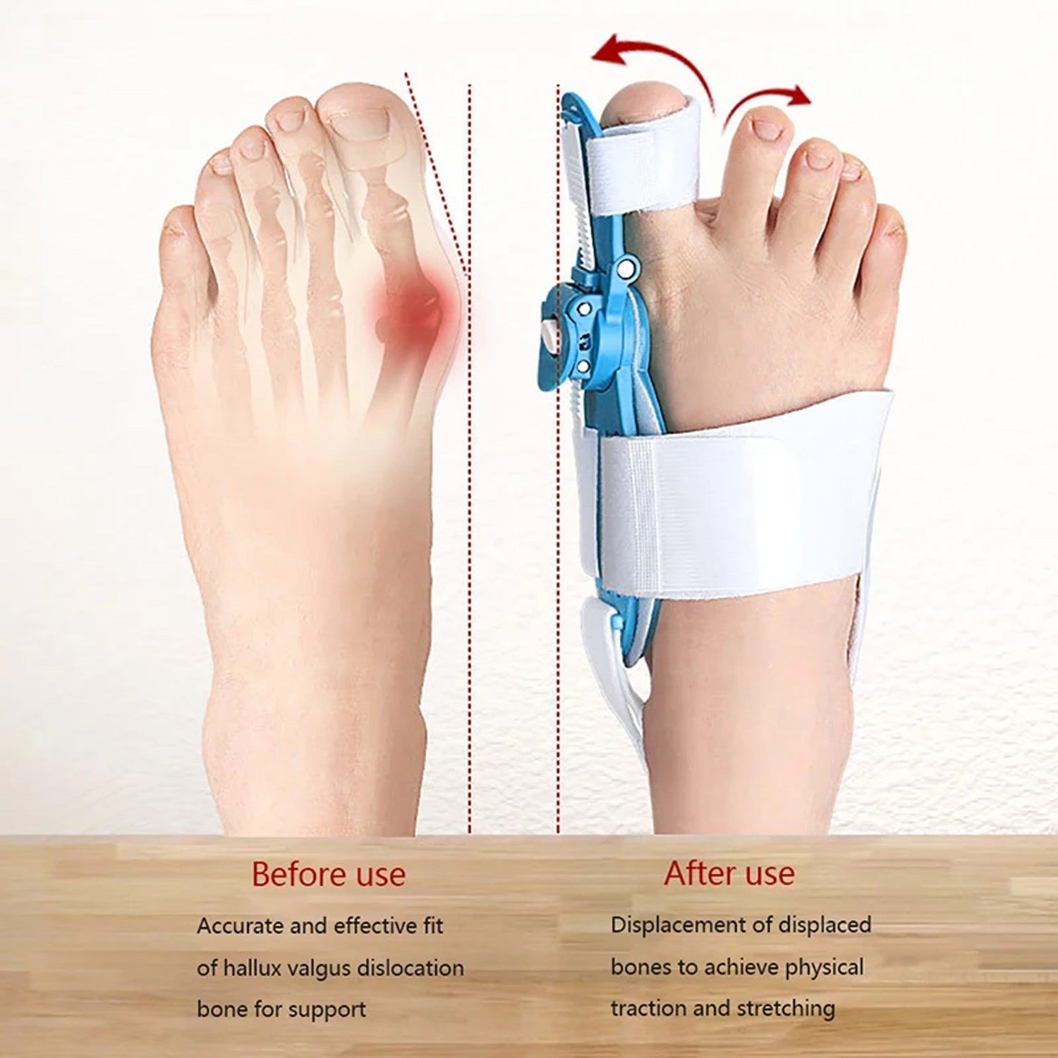Bunion Support Splint. Valgus And Bunion Valgus, Corrector, Hallux Valgus Corrector, Adjustable Bunion Valgus Protective Cover For Men And Women Your Brand