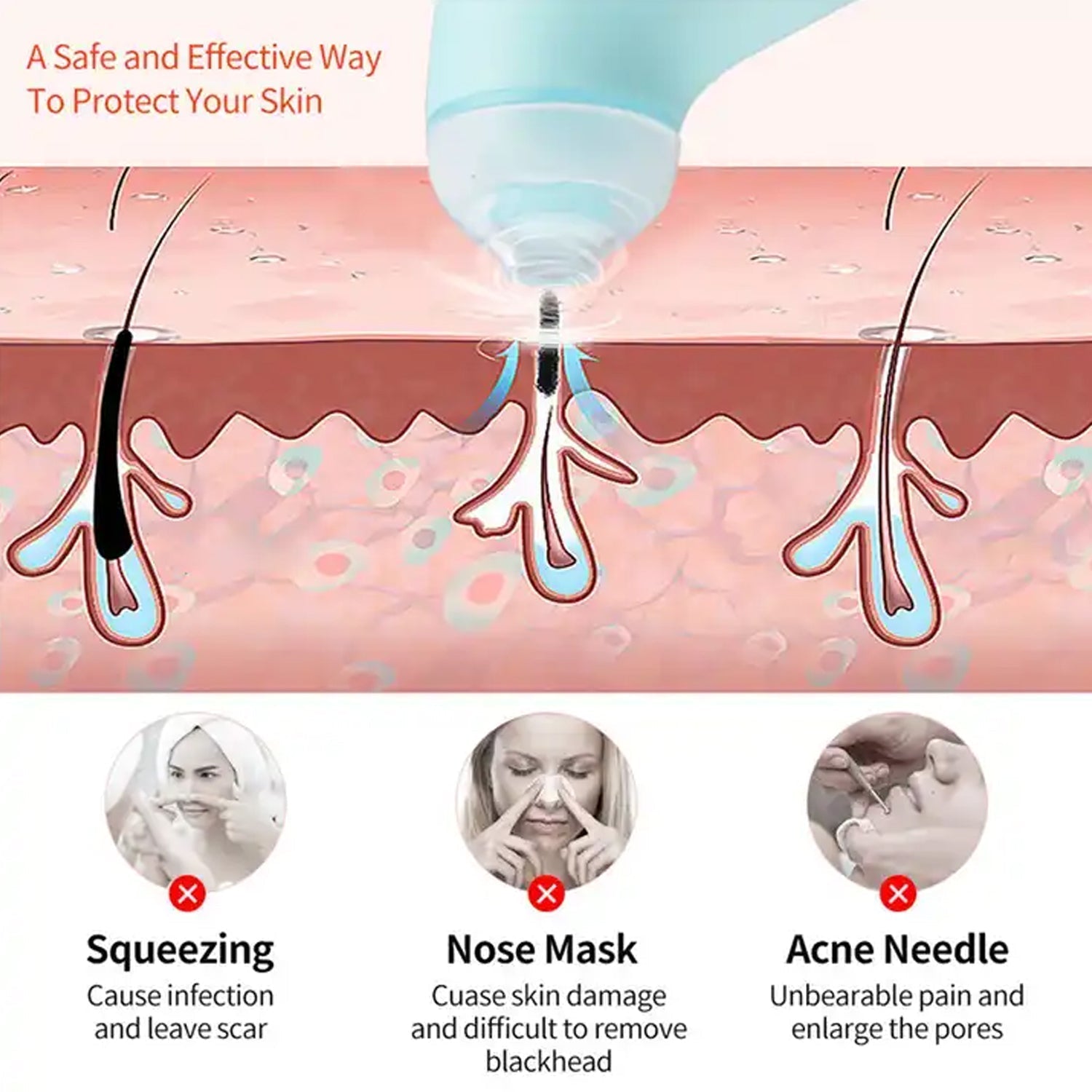 Vacuum Blackhead Machine, Reduce Spot Mini Handheld Lifting Massage Facial Blackhead Remover For Skin Care (1 Pc) Your Brand