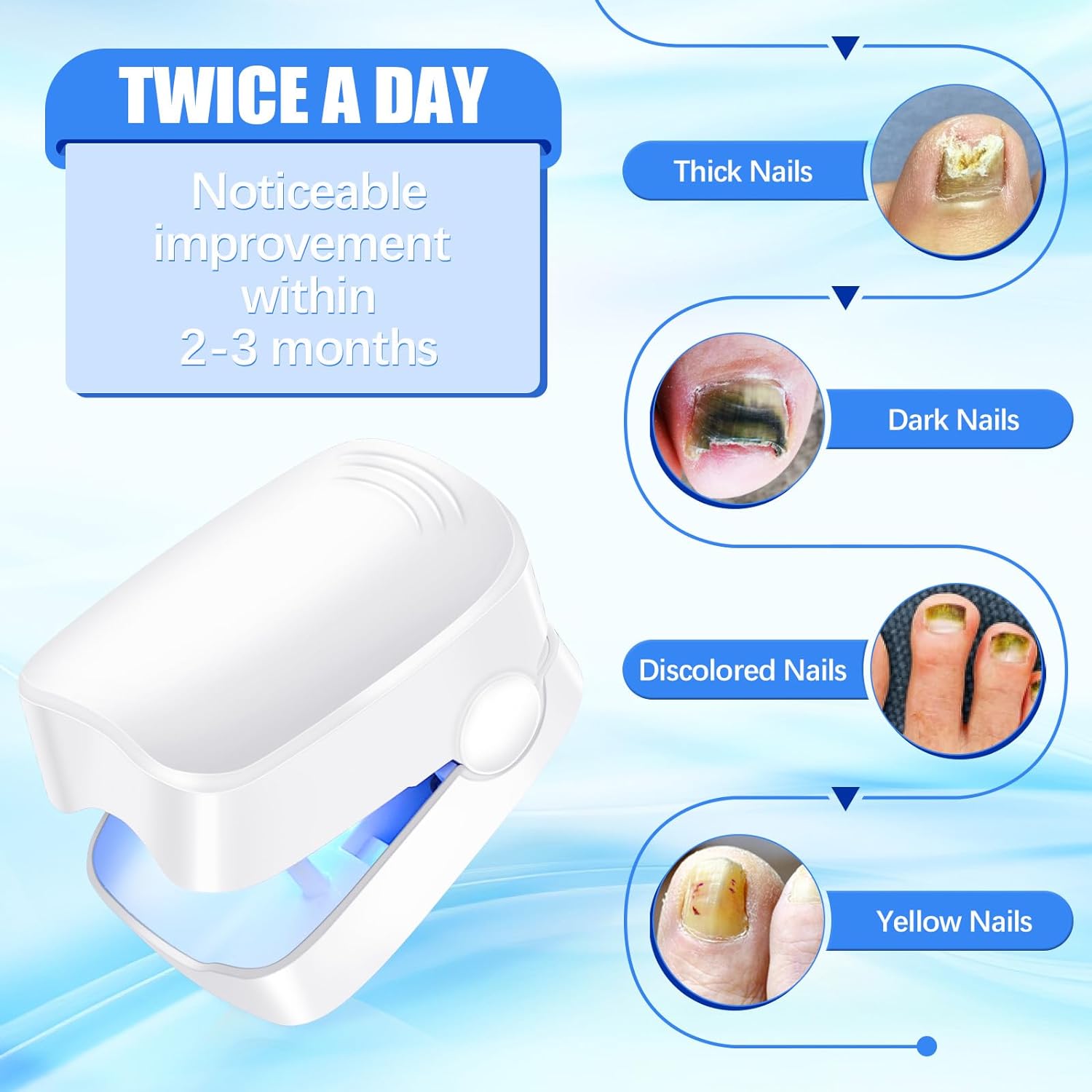 Rechargeable Nail Fungus Treatment for Toenail, Toe Nail Fungal Treatment Nail Fungus Laser Device, Anti-Fungal Nail Treatment for Hand & Feet Infections Remover for Home Use Your Brand