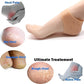 Silicone Heel Sleeves for Kids