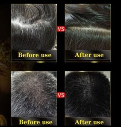 BLOSDREAM Black Hair Shampoo 3 in 1-100ml (Pack of 2) Roposo Clout