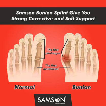 Toe Straightener Bunion Corrector for Women and Men Dropdash
