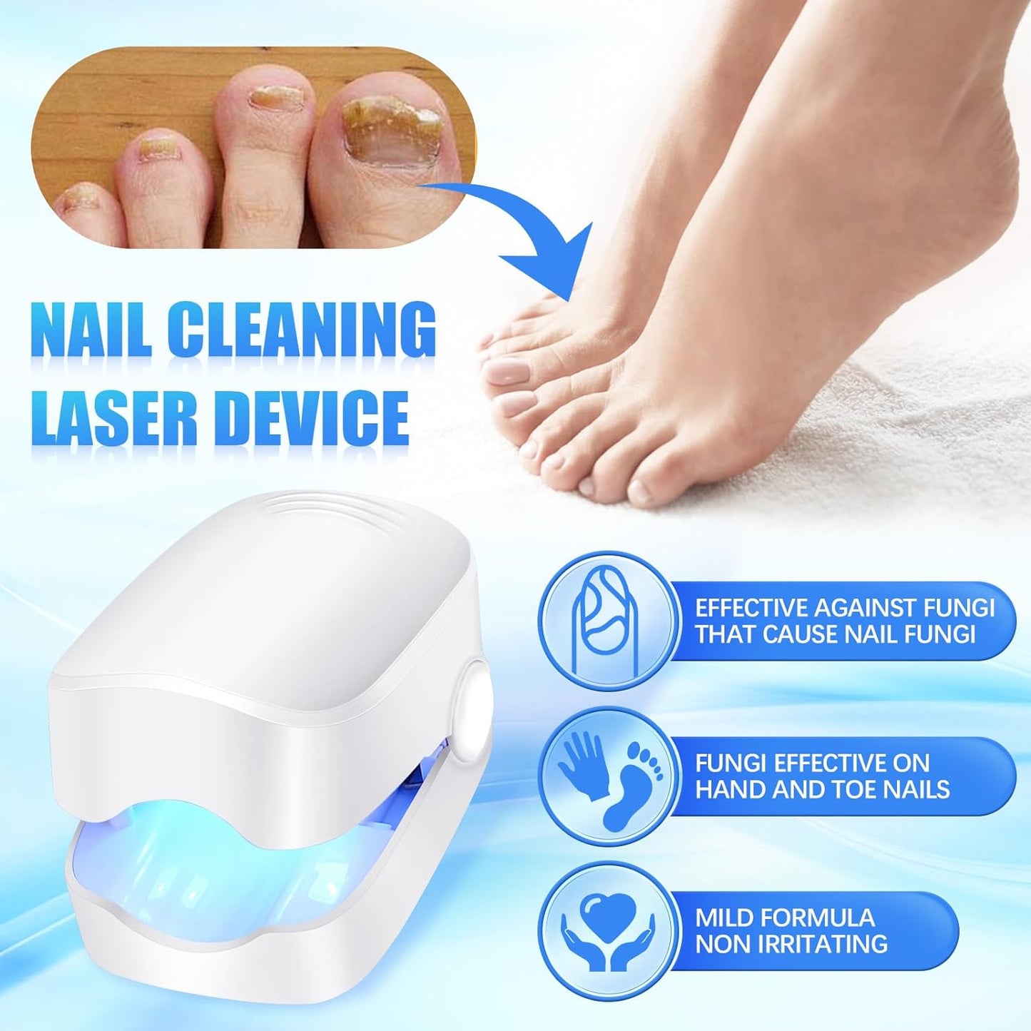 12915 Rechargeable Nail Fungus Treatment For Toenail Toe Nail Fungal Treatment Nail Fungus Laser Device Anti-fungal Nail Treatment For Hand  Feet Infections Remover For Home Use Wukusy