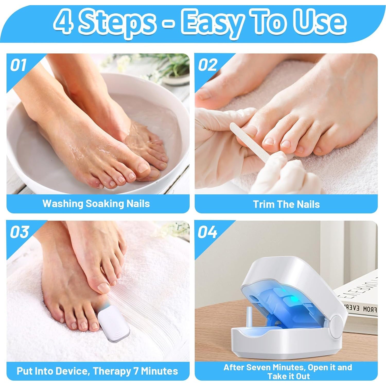 12915 Rechargeable Nail Fungus Treatment For Toenail Toe Nail Fungal Treatment Nail Fungus Laser Device Anti-fungal Nail Treatment For Hand  Feet Infections Remover For Home Use Wukusy