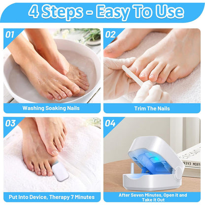 12915 Rechargeable Nail Fungus Treatment For Toenail Toe Nail Fungal Treatment Nail Fungus Laser Device Anti-fungal Nail Treatment For Hand  Feet Infections Remover For Home Use Wukusy